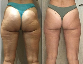 Wonder Axon treatment results
