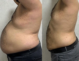 Wonder Axon treatment results