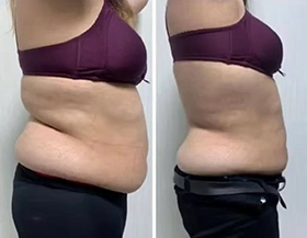 Wonder Axon treatment results