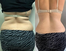 Wonder Axon treatment results