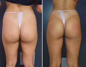 Wonder Axon treatment results